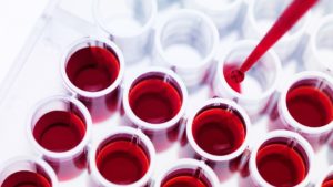 анализ крови на присутствие специфических антител